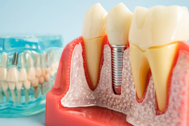 Professional  Dental Services in Webster Groves, MO